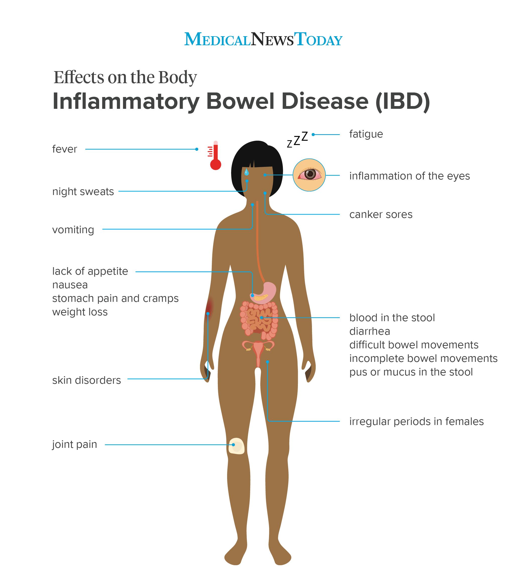Inflammatory bowel disease: Causes, symptoms, and treatments