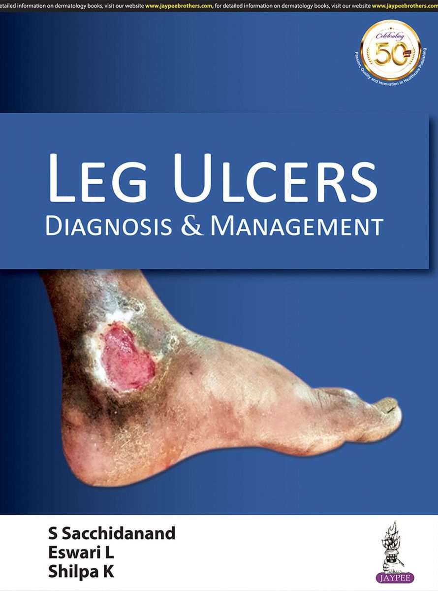 Leg Ulcers: Diagnosis And Management: Buy Leg Ulcers: Diagnosis And ...
