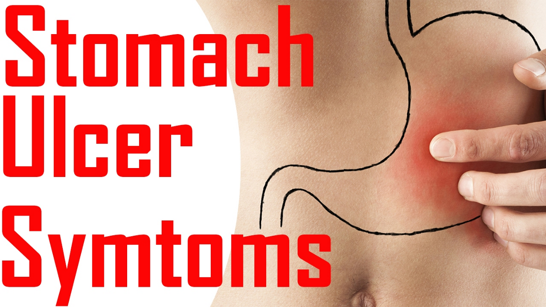 Lets understand Stomach Ulcers.. There is no clear ...