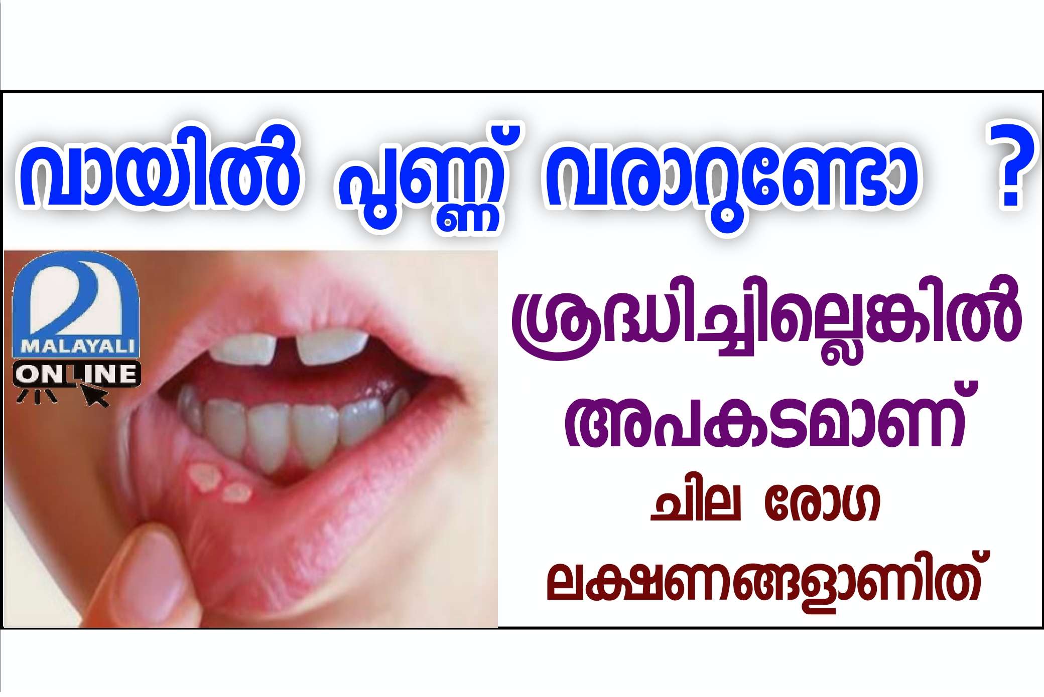 Main causes of mouth ulcers
