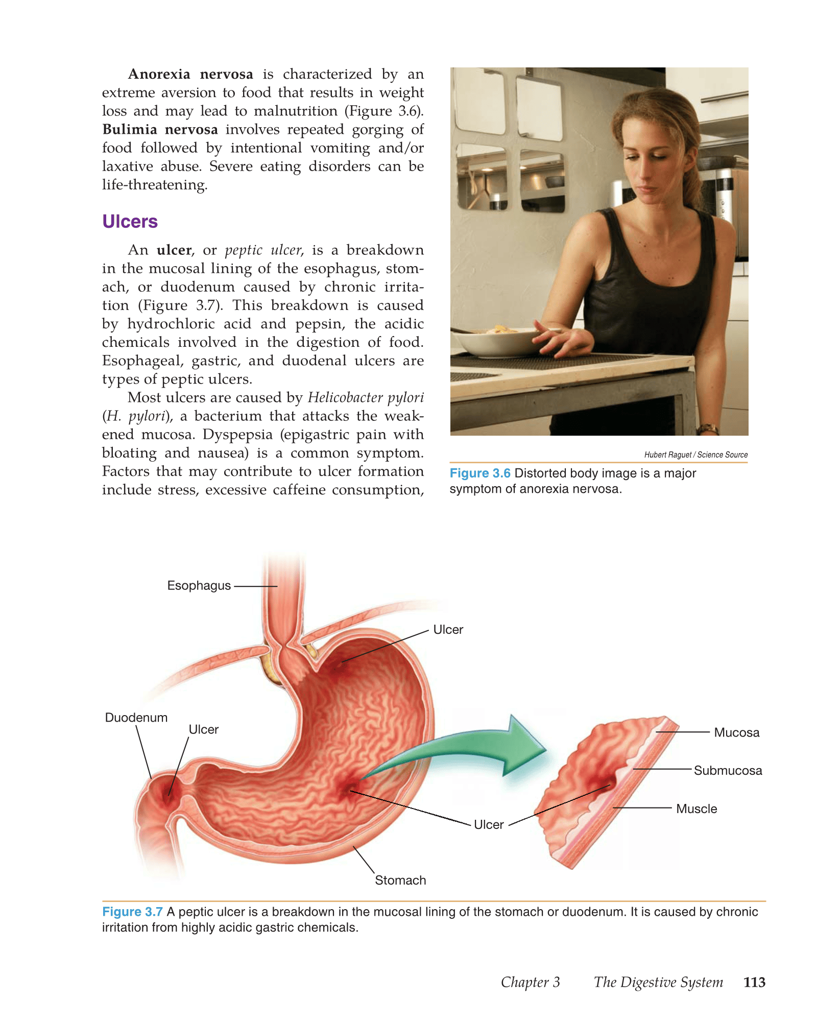 Medical Terminology: Mastering the Basics, 1st Edition page 113