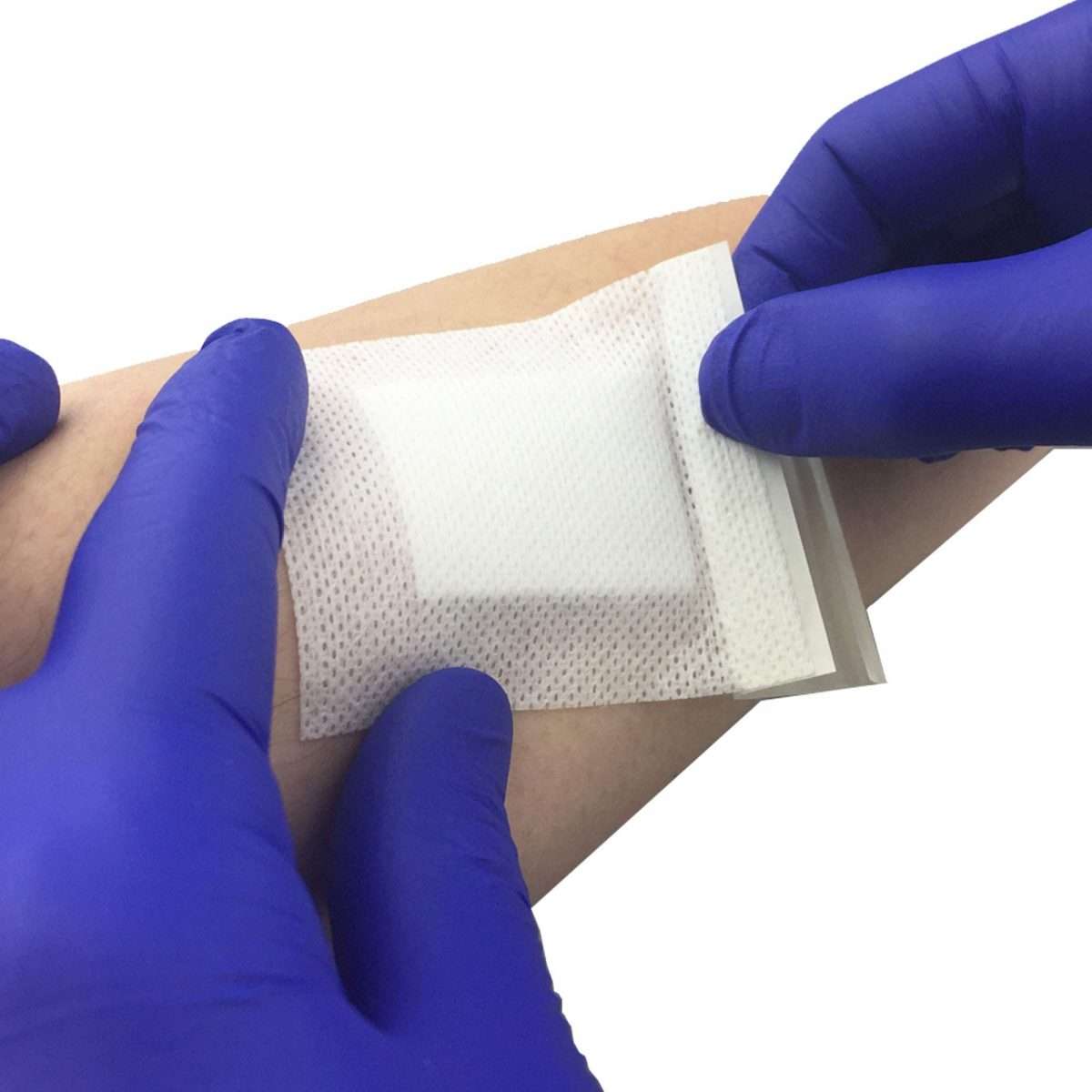 Pack of 10 Adhesive Sterile Wound Dressings