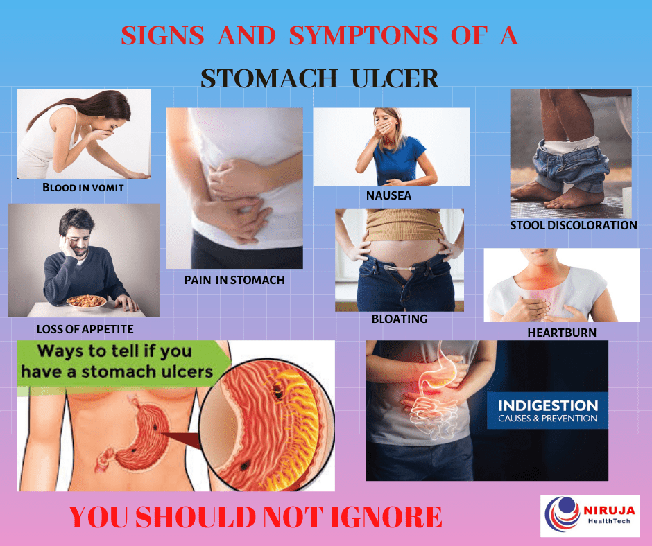 peptic ulcer a painful ulceration in the stomach niruja