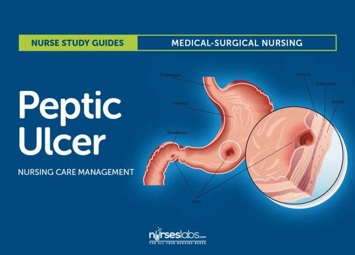 Peptic Ulcer Disease Nursing Care and Management: Study Guide