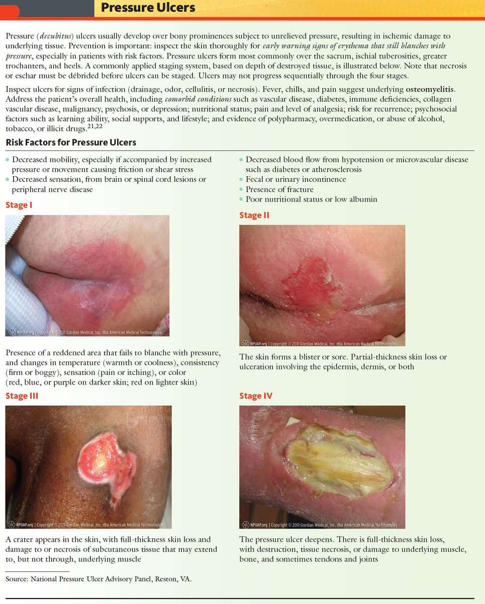 Pressure Sore Ulcer Stages