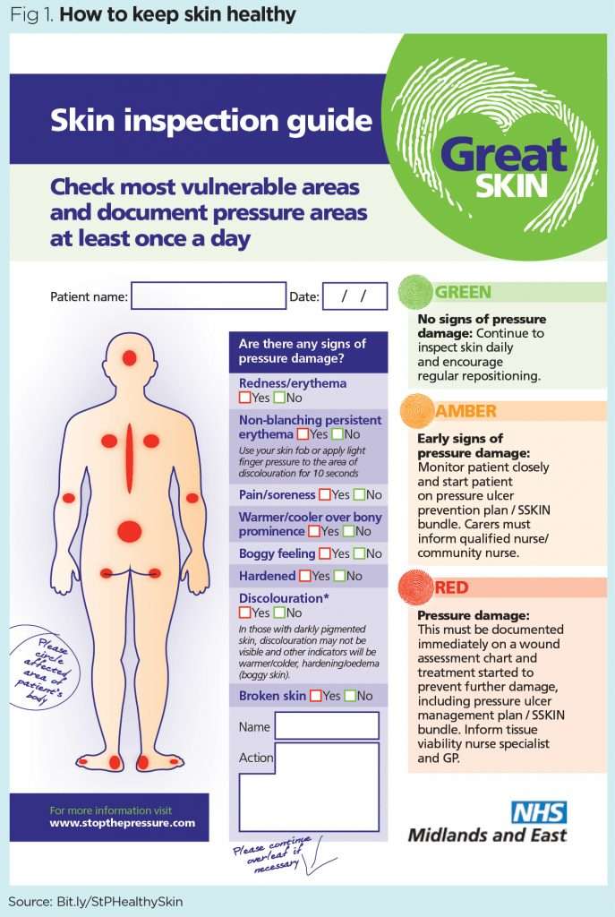 Pressure ulcer education 3: skin assessment and care ...