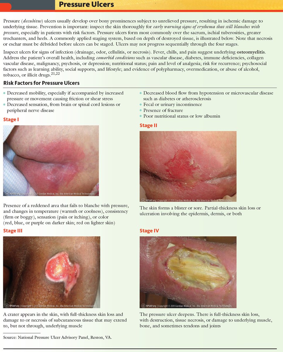 Stage 2 Pressure Ulcer Pictures to Pin on Pinterest