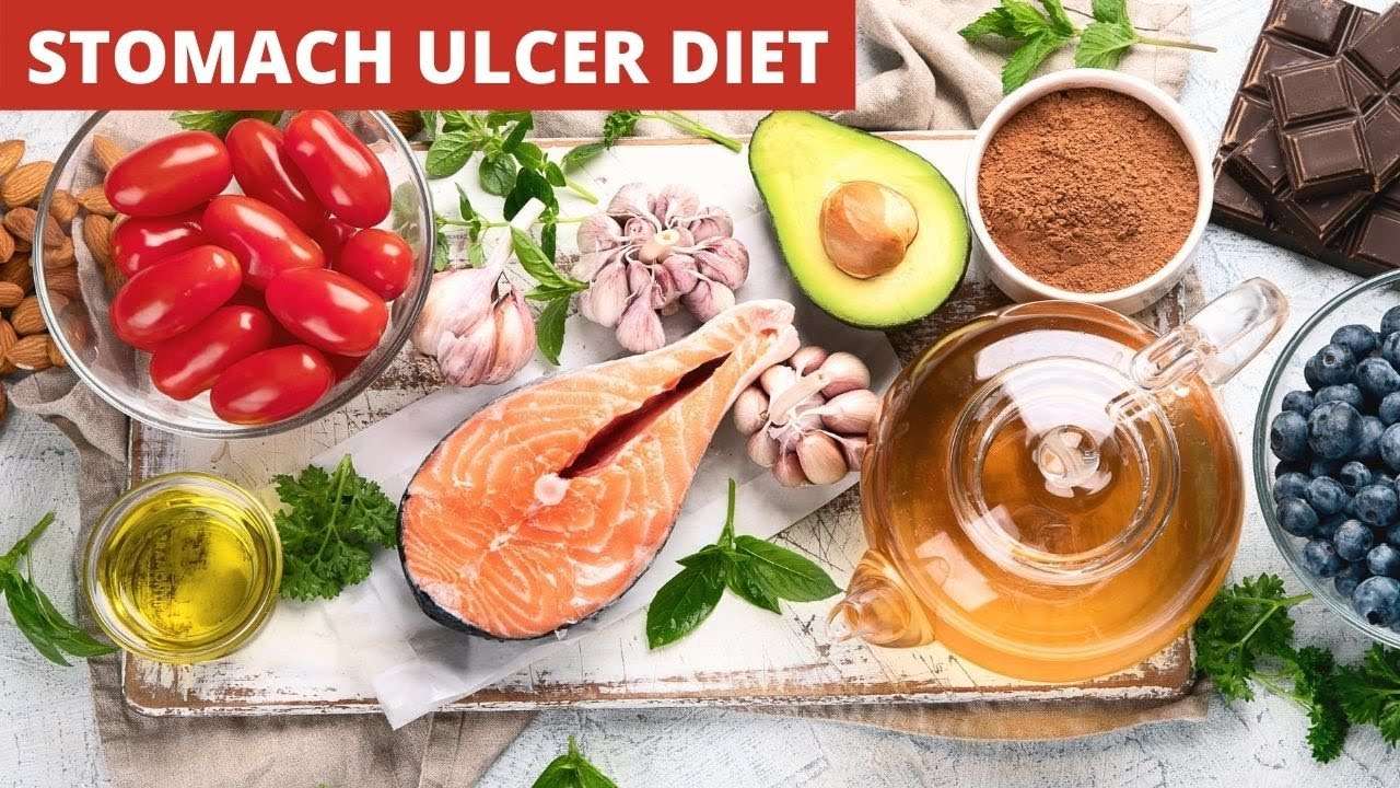 Stomach Ulcer Diet Menu