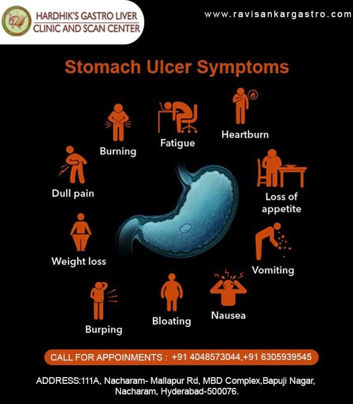 Symptoms of stomach ulcers: in 2020
