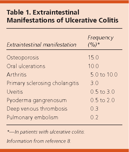 Table 1 from Ulcerative colitis: diagnosis and treatment.