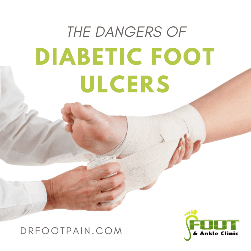 The dangers of Diabetic Foot Ulcers
