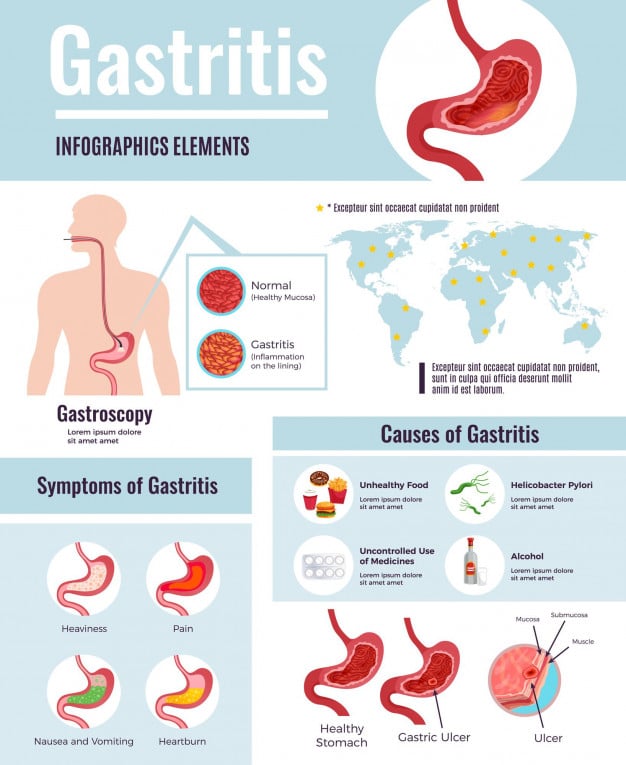 Treatment for Gastritis
