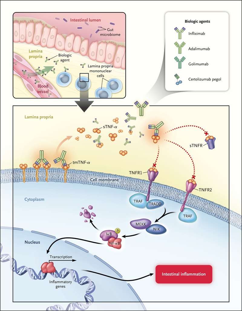Tumor Necrosis Factor Inhibitors for Inflammatory Bowel Disease
