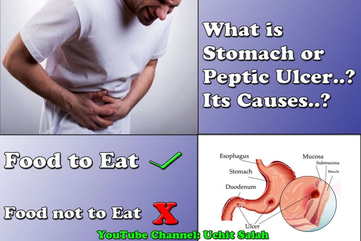 Uchit salah : Stomach ulcer cure home remedies
