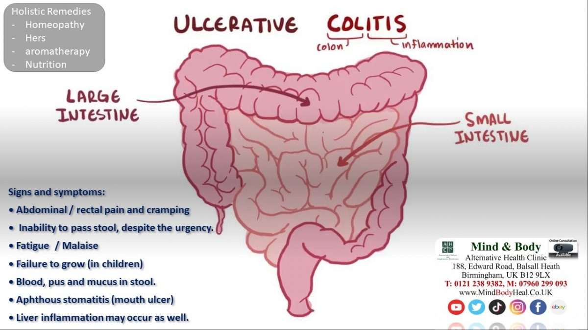 Ulcerative Colitis â Mind &  Body Holistic Health Clinic