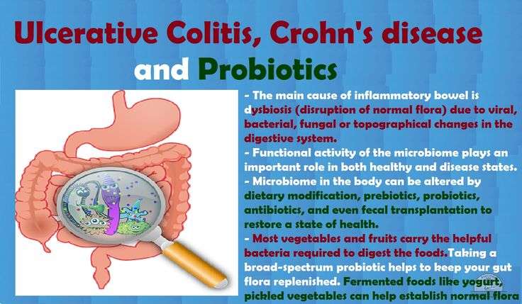 Ulcerative Colitis, Crohn