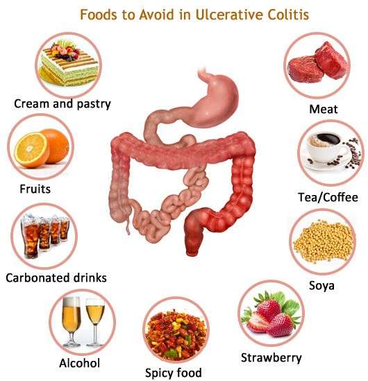 Ulcerative Colitis deals with inflamed colon, there are many food items ...