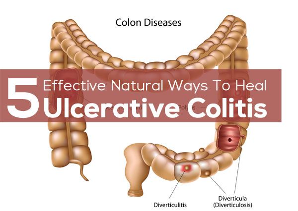 Ulcerative Colitis Diet  5 Effective Natural Ways To Heal Ulcerative