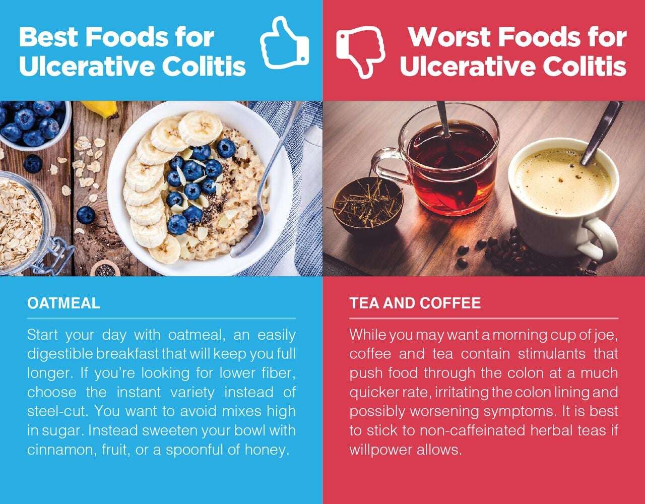 Ulcerative Colitis Diet: Best and Worst Foods When Living ...