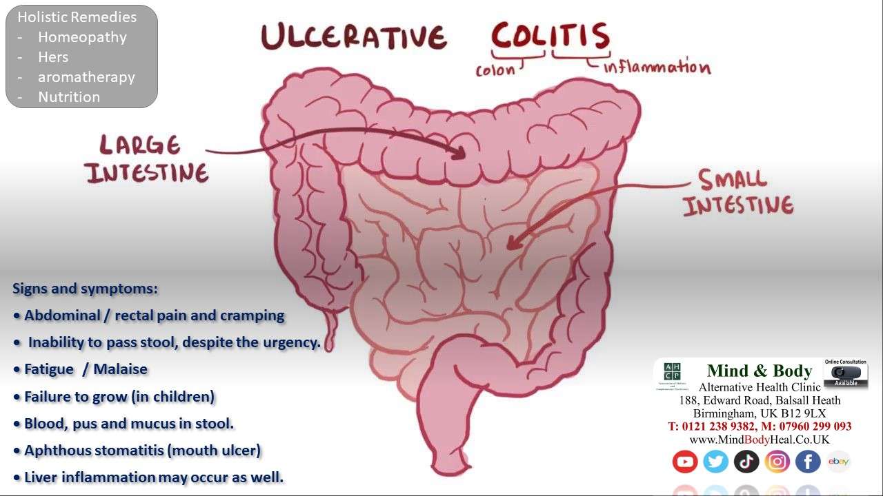Ulcerative Colitis  Mind &  Body Holistic Health Clinic