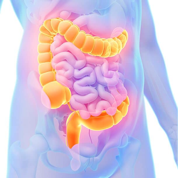 Ulcerative Colitis Symptoms, Causes, and Treatment
