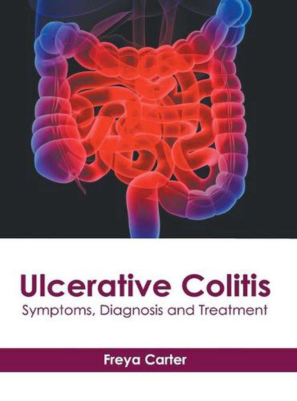 Ulcerative Colitis: Symptoms, Diagnosis and Treatment ...