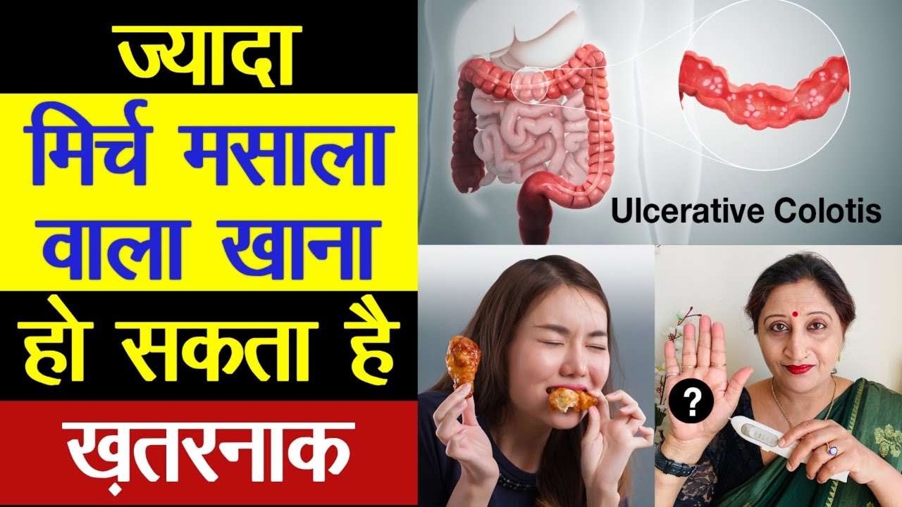 Ulcerative Colitis Treatment In Hindi