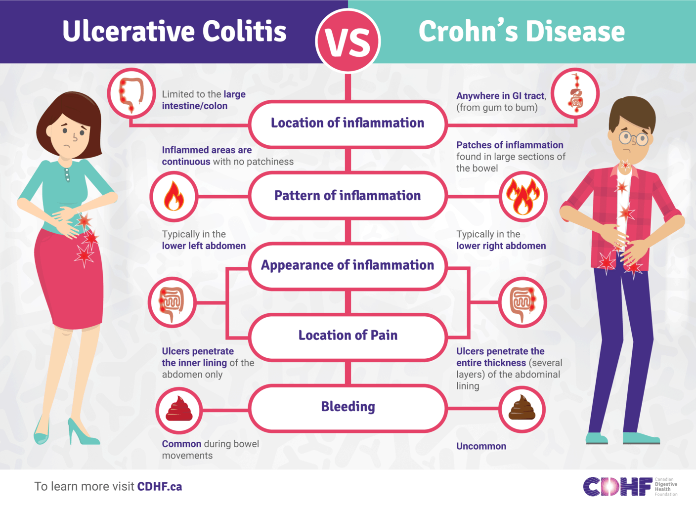 Ulcerative Colitis vs Crohn