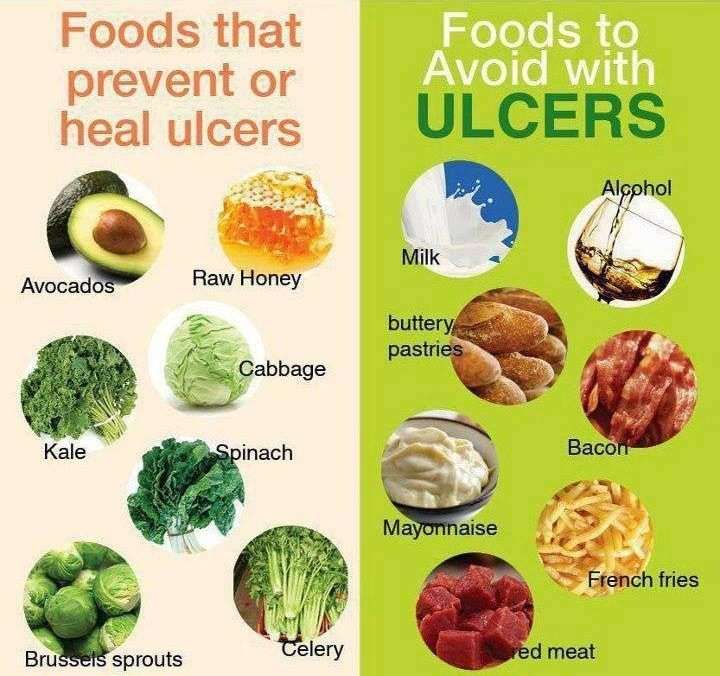 Ulcers the best foods