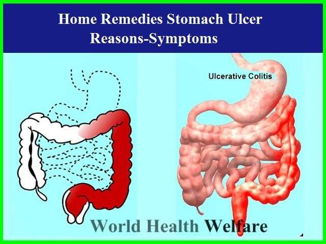 What Do Intestinal Ulcers Feel Like