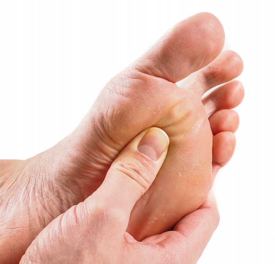 What is a diabetic foot ulcer?