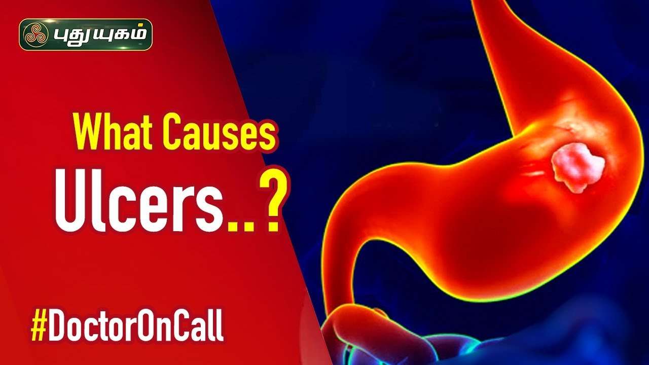 What Is a Stomach Ulcer? Causes &  Symptoms