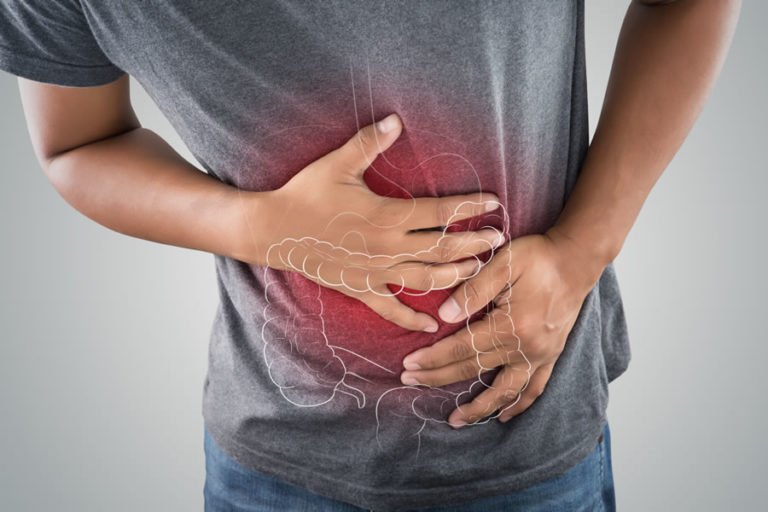 What is Colitis? Colitis Treatment Clearwater Tampa, Florida