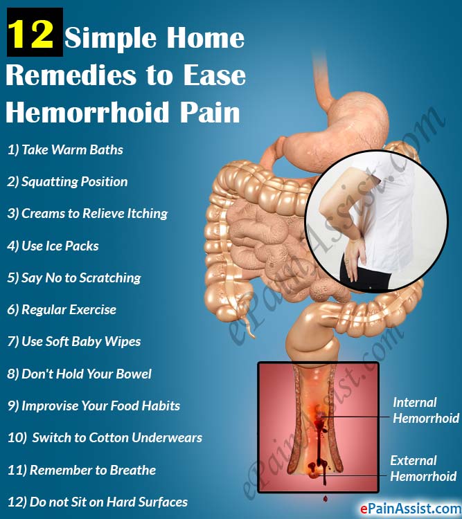 What To Use For Hemorrhoids Pain