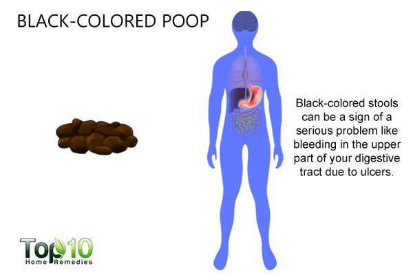 What Your Poop Says about Your Health